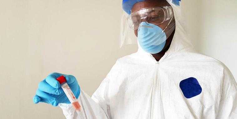 Medias241.com-gabon-COVID-19: 166 CAS CONTRÔLÉS POSITIFS, 8 NOUVELLES GUÉRISONS