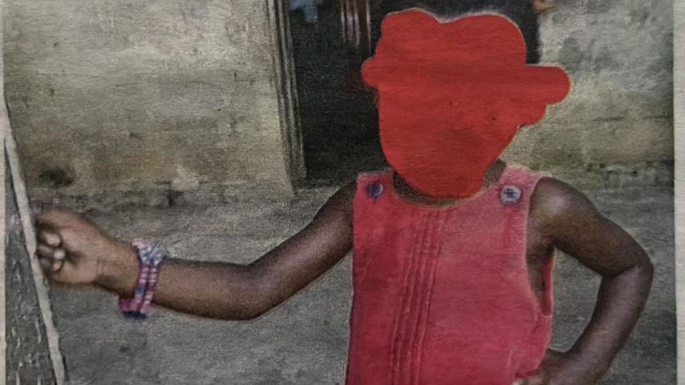 Medias241.com-Gabon-Lambaréné : né avec 2 sexes, ses parents appellent à l’aide