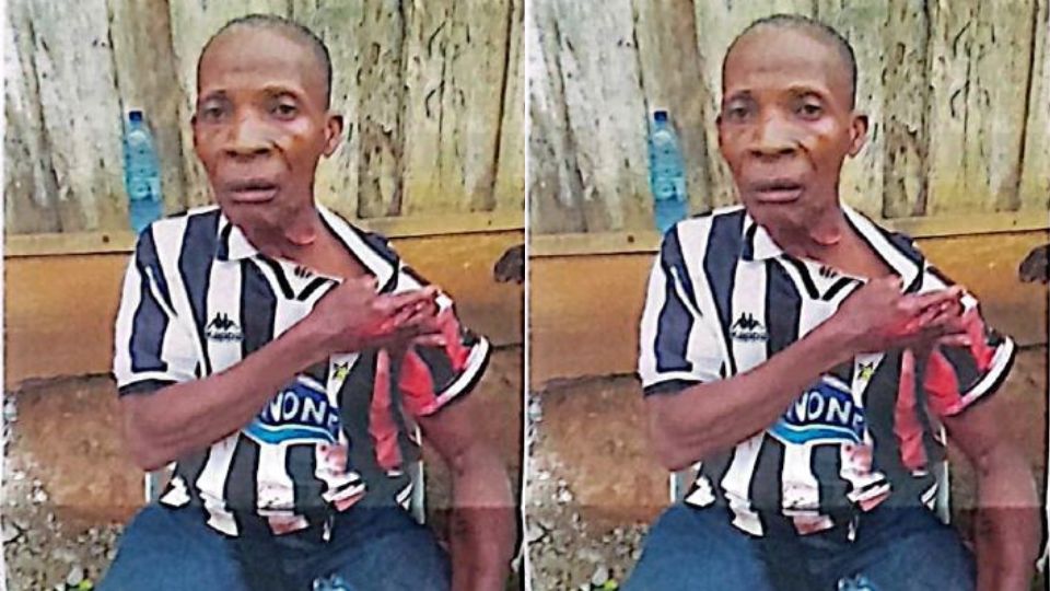 Medias241.com-Gabon-Kango : 87 points de suture pour avoir tenté de séparer une bagarre